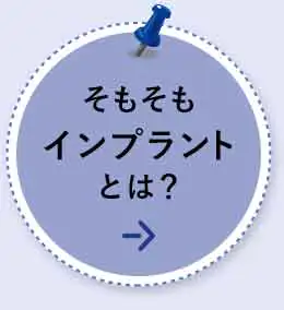 そもそもインプラントとは？