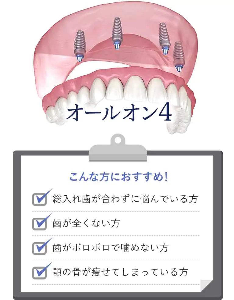 インプラント