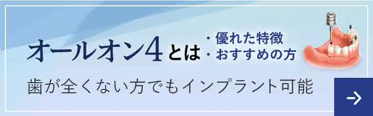 オールオン4とは