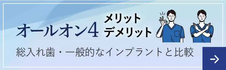 オールオン4のメリット・デメリット