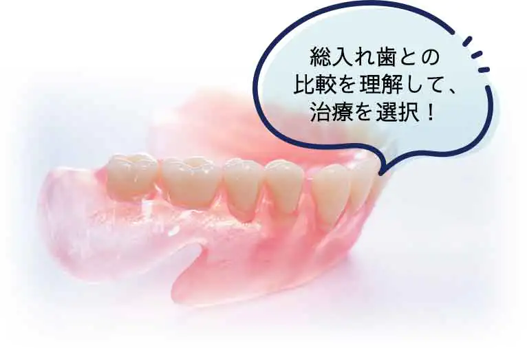 総入れ歯との比較を理解して、治療を選択