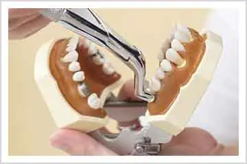 抜歯とインプラントを一度にやると痛みは二倍出るのですか？